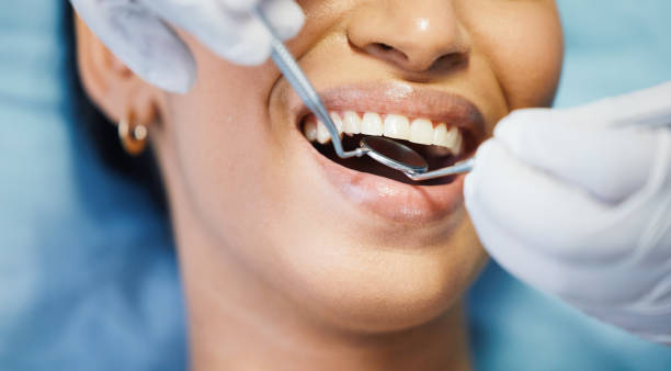 Best After-Hours Emergency Dentist in Hillsboro, MO