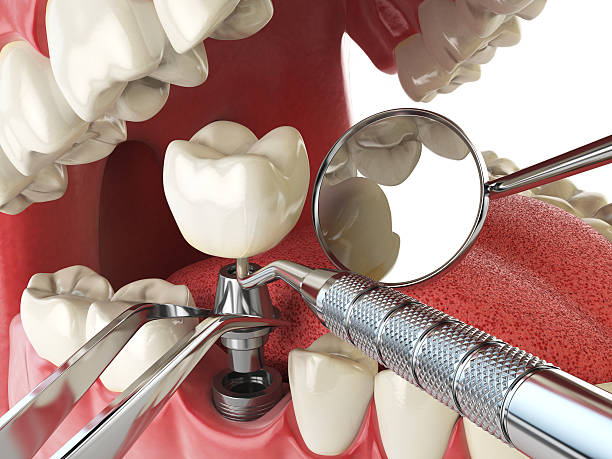 Best Emergency Treatment for Toothache in Hillsboro, MO